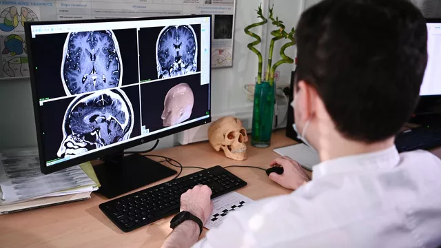 Российские ученые модернизировали платформу для исследований мозга